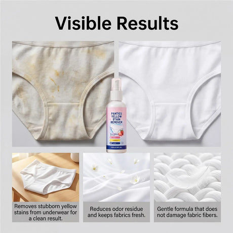 Underwear Stain Remover Spray 100ml Blood Secretion Yellow Spot Cleaner Gentle Skin Safe No Scrub Laundry Detergent for Lingerie